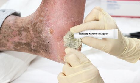 AdobeStock.com: © H. Brauer Wundbehandlung mit MANC